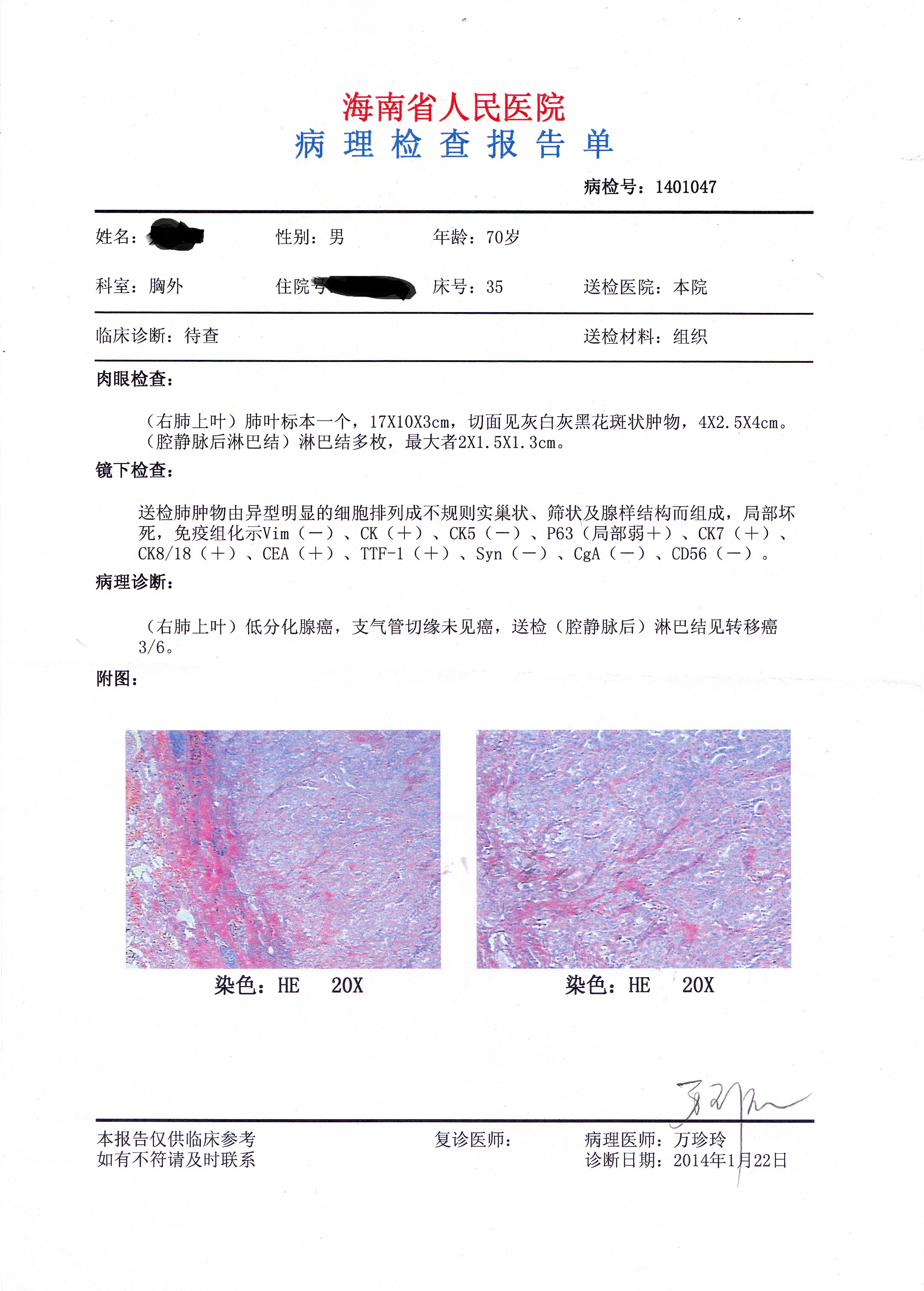 病理报告