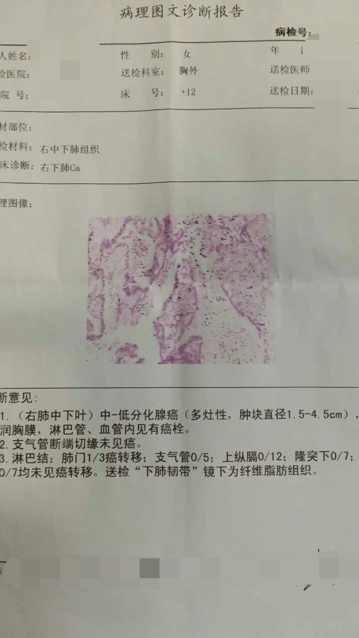 我妈的病理报告