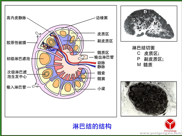 lymph node 3.PNG