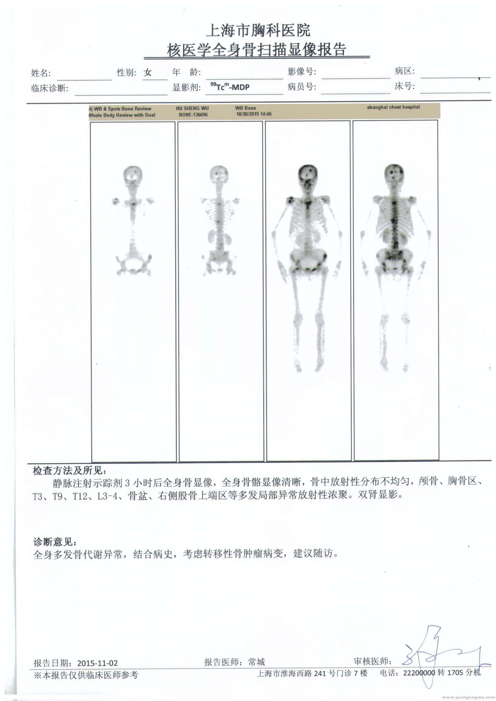 21 全身骨扫描