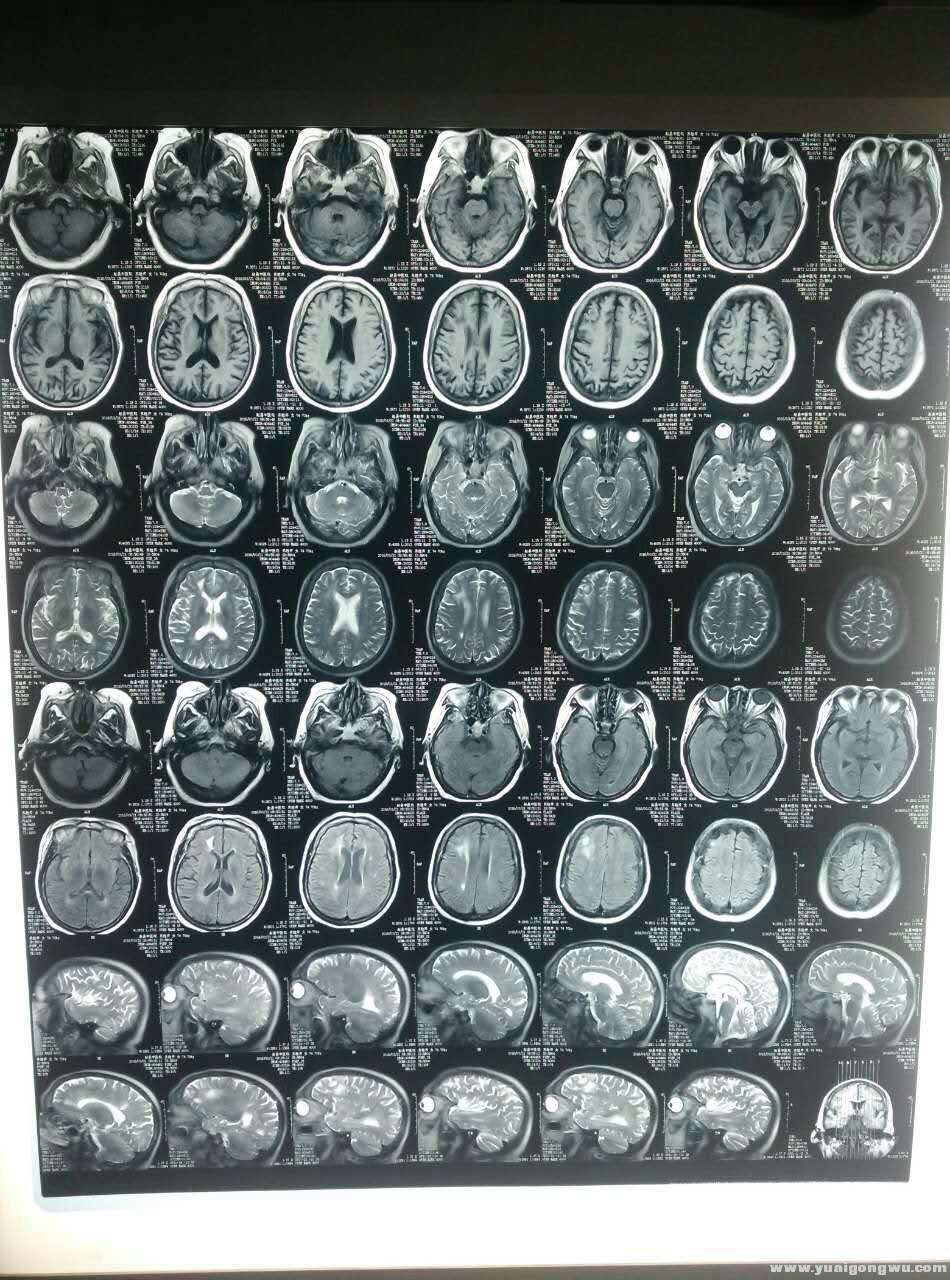 MRI 2016-3-21.jpg