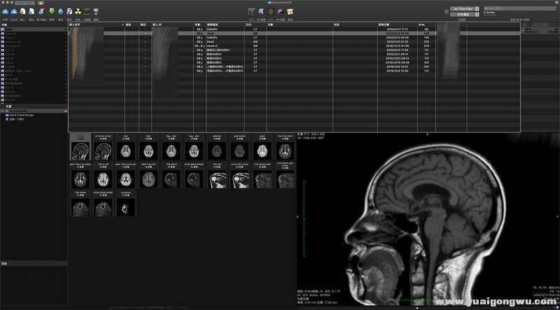 OsiriX 论坛.jpg